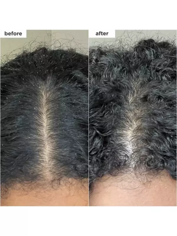 Шампунь-Скраб для кожи головы Scalp Revival с микроотшелушивающим углем и кокосовым маслом Briogeo, объем 227 мл